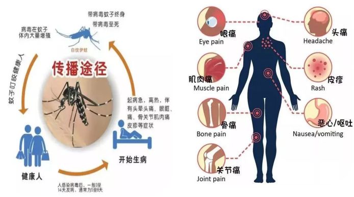 登革热症状及传染性解析，人际传播可能性探讨