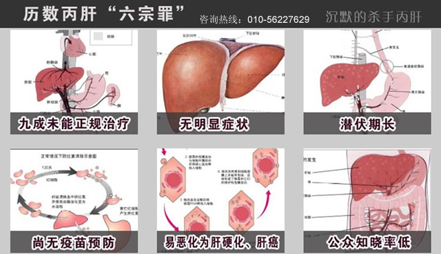 丙肝传播途径与防控重要性解析